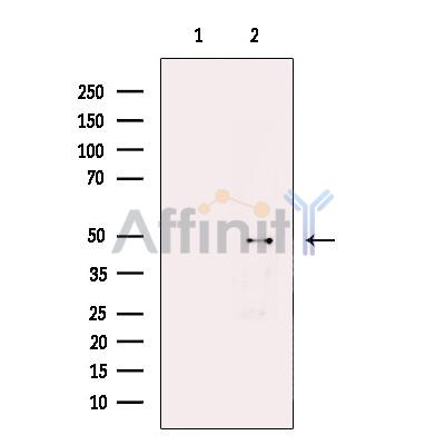 Валидация Affinity DF13587 - 9062