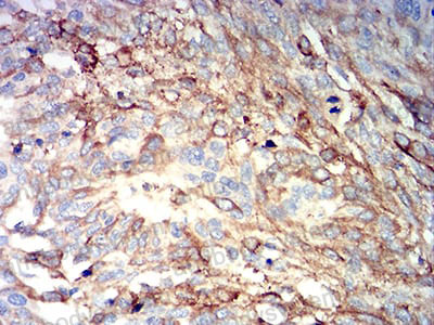 Валидация AntibodySystem RHJ93202