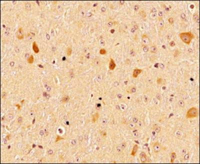 Валидация AssayVector ARM2671(5021)