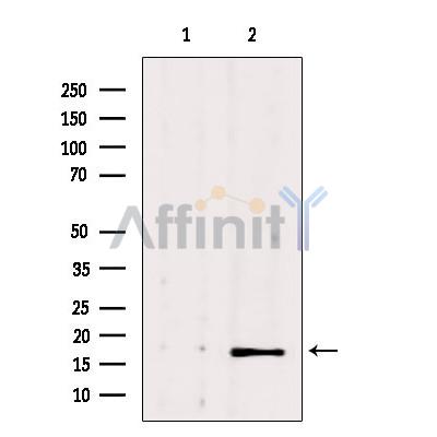 Валидация Affinity DF6062 - 17273