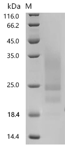 SDS-PAGE