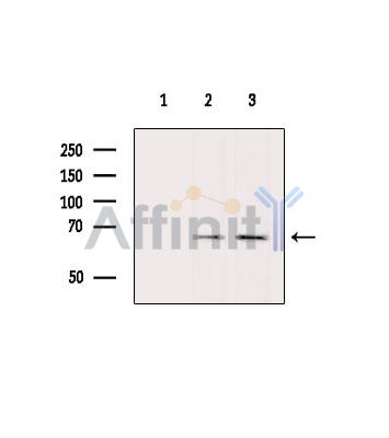 Валидация Affinity DF6924 - 18524