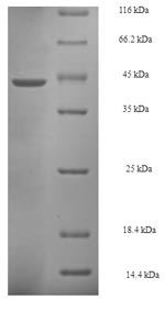 SDS-PAGE