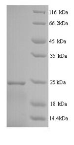 SDS-PAGE