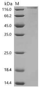 SDS-PAGE