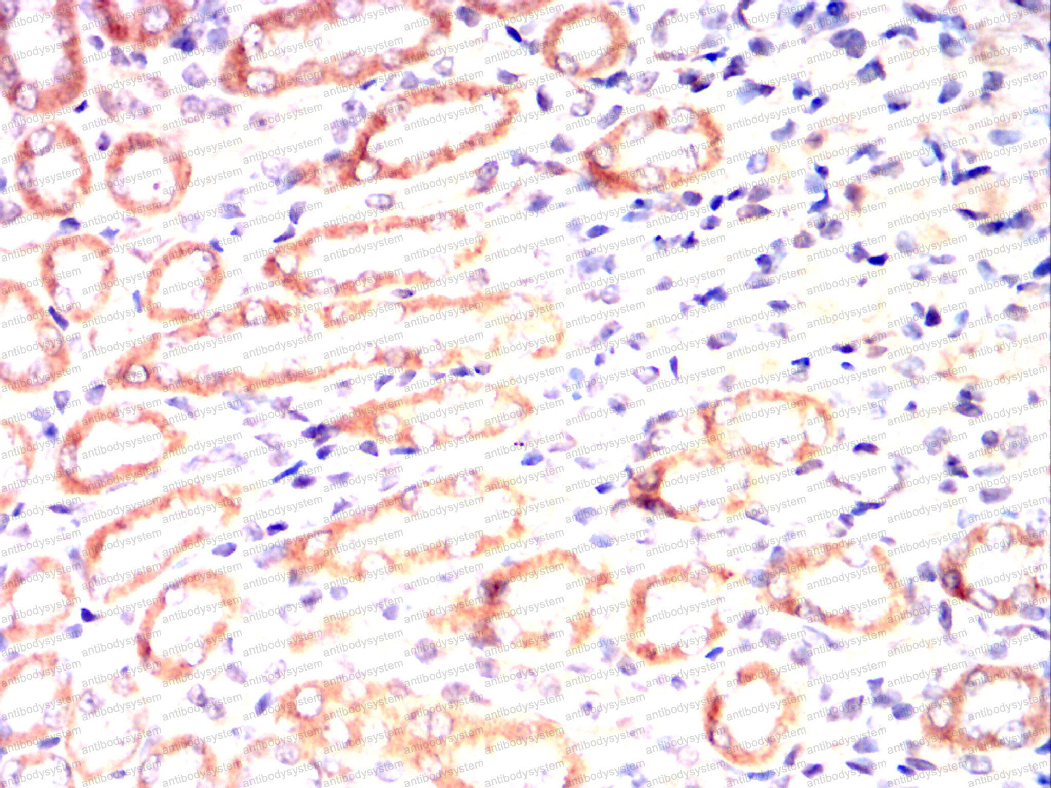 Валидация AntibodySystem RHC15302 (676)