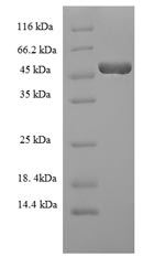 SDS-PAGE
