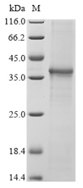 SDS-PAGE