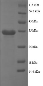 SDS-PAGE
