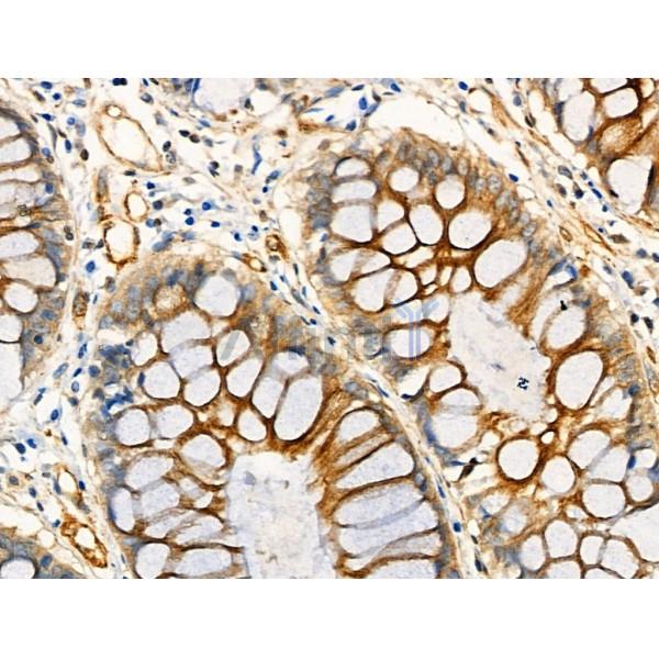 Валидация Affinity AF4351 - 2178