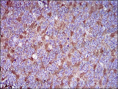 Валидация AntibodySystem RHC07802 (597)