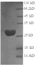 SDS-PAGE
