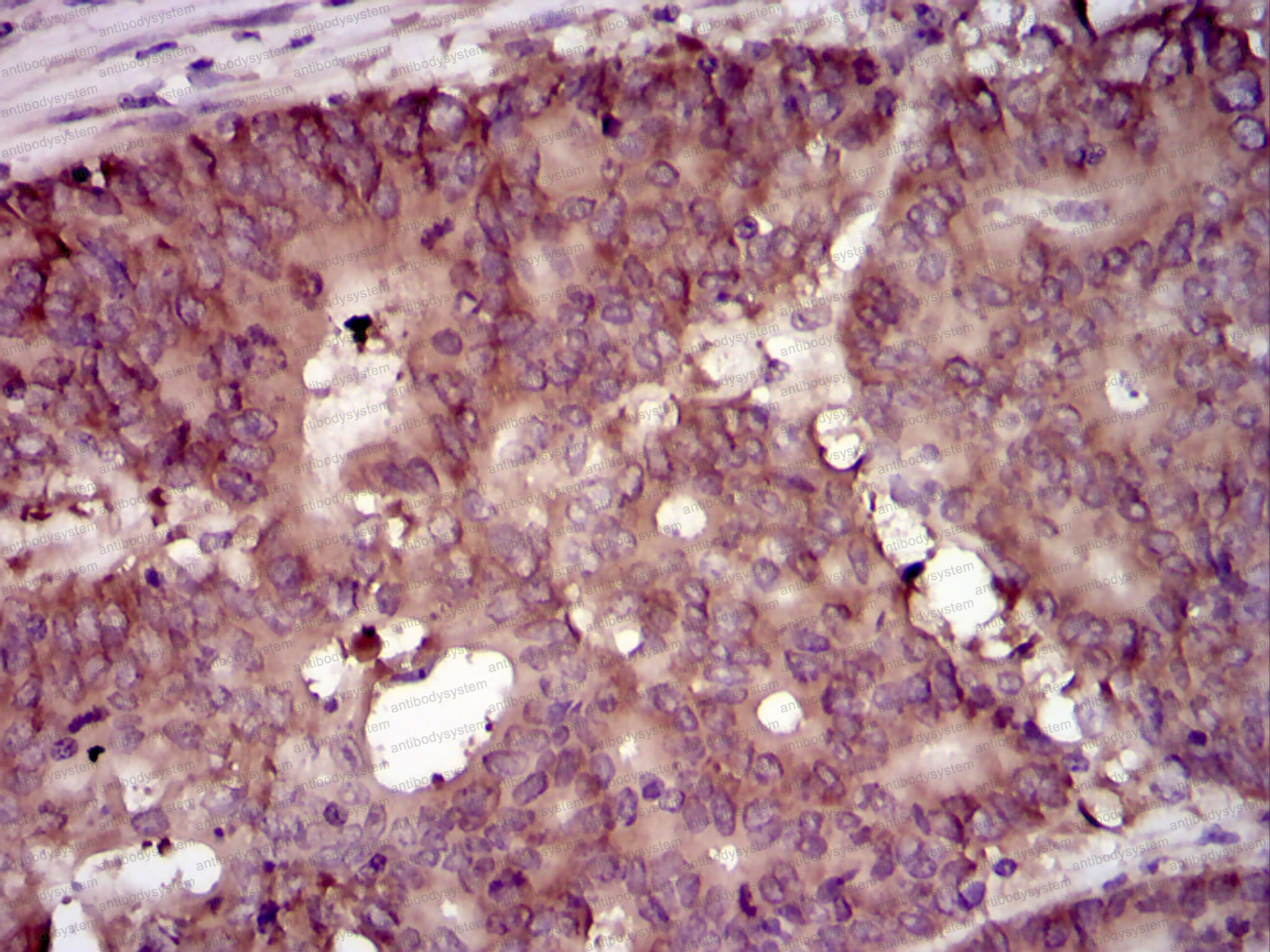 Валидация AntibodySystem RHD59603