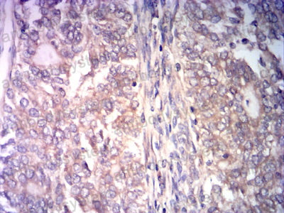 Валидация AntibodySystem RHD64404