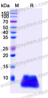 YHJ88602, SDS-PAGE