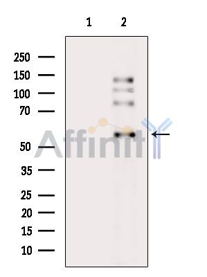 Валидация Affinity DF6564 - 18002