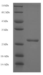 SDS-PAGE