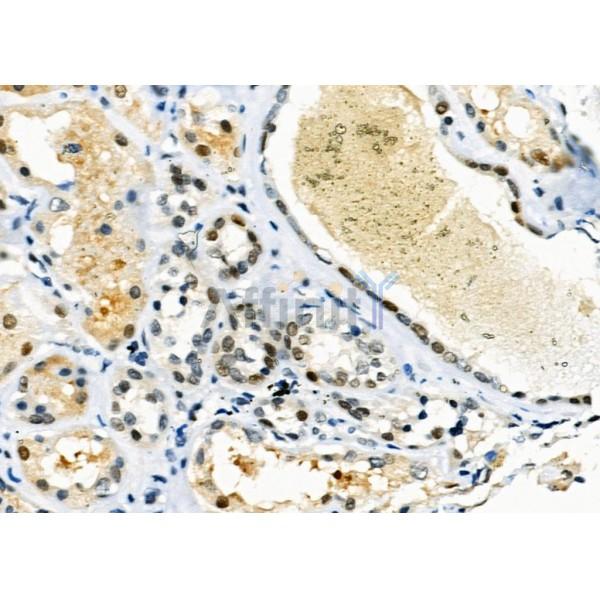 Валидация Affinity DF2429 - 13040