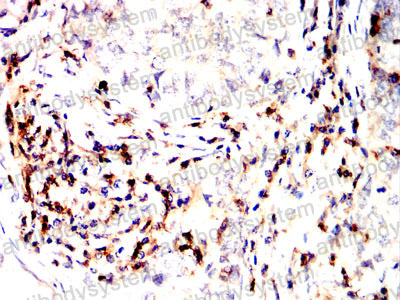 Валидация AntibodySystem RHC34009 (935)