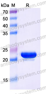 YHK62802, SDS-PAGE