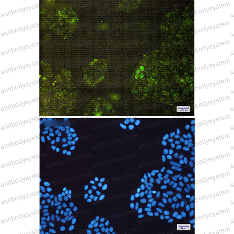 Валидация IF - AntibodySystem RHJ86301