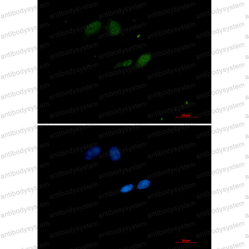 Валидация IF - AntibodySystem RHF60801