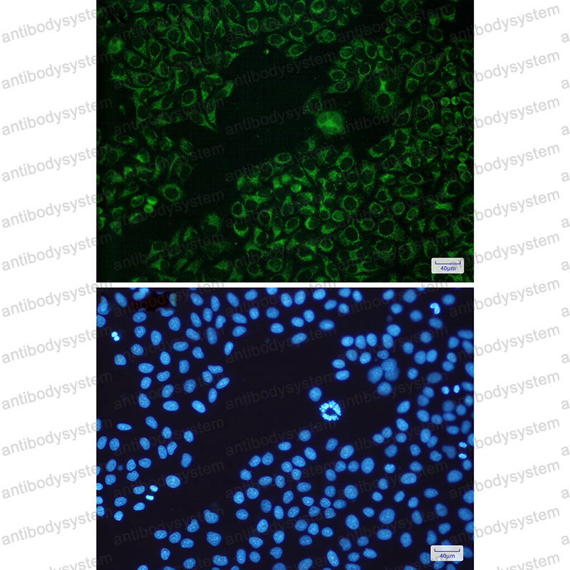 Валидация IF - AntibodySystem RHJ34801