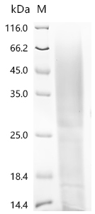 SDS-PAGE
