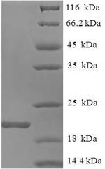 SDS-PAGE