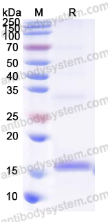 YVV40804, SDS-PAGE