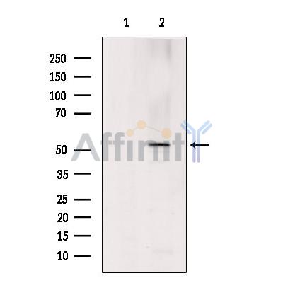 Валидация Affinity AF9062 - 4815