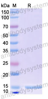 Валидация SDS-PAGE - AntibodySystem RHF37502