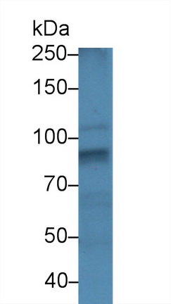 13915