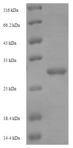SDS-PAGE