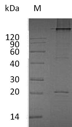 SDS-PAGE