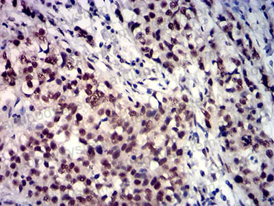 Валидация AntibodySystem RHD38002 (1537)