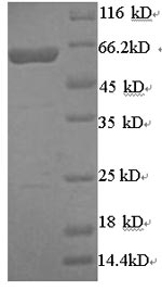 SDS-PAGE