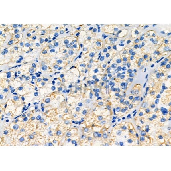 Валидация Affinity DF7320 - 19012