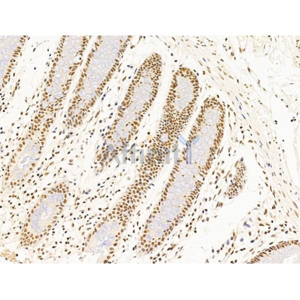 Валидация Affinity DF13624 - 9147