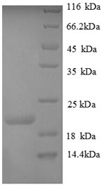 SDS-PAGE
