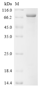 SDS-PAGE