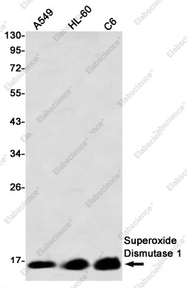Вестерн-блоттинг, Superoxide Dismutase 1, клетки A549, HL-60, C6