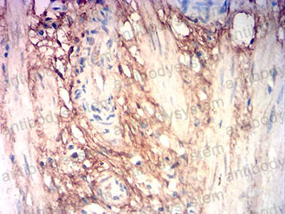 Валидация AntibodySystem RHB97602