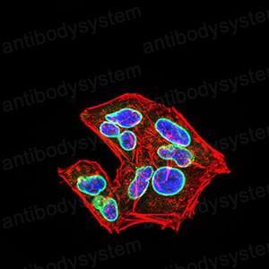 Валидация IF - AntibodySystem RHF98703 (1140)