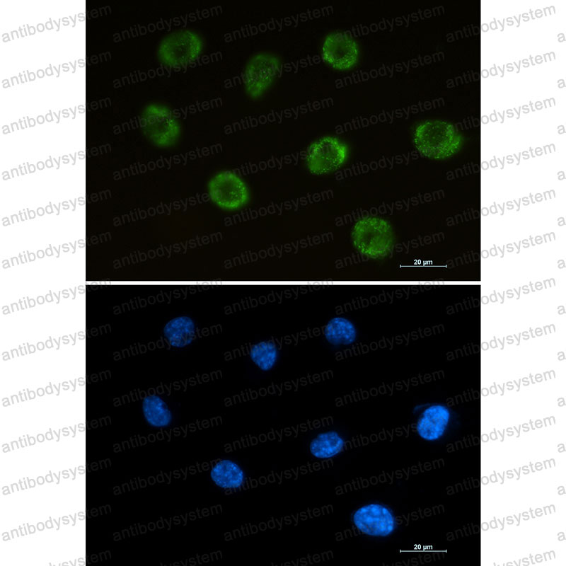 Валидация IF - AntibodySystem RHH33503