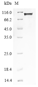 SDS-PAGE