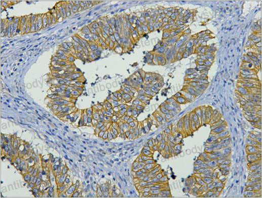 Валидация AntibodySystem RHC36010