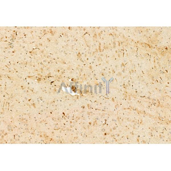 Валидация Affinity AF6278 - 3533