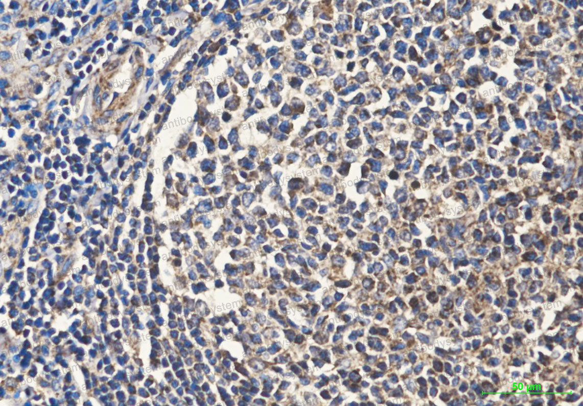 Валидация AntibodySystem RHF80805