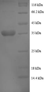 SDS-PAGE